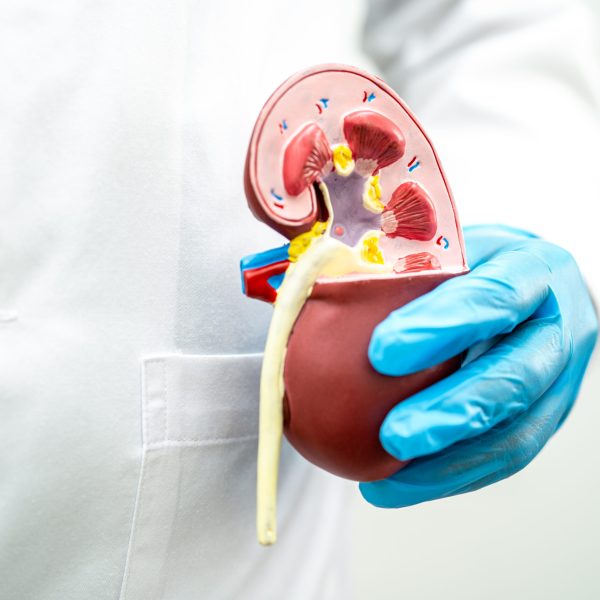 Kidney disease, Chronic kidney disease ckd, Doctor hold model to study and treat in hospital.